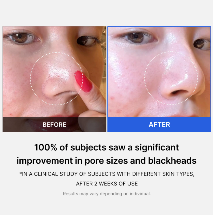Zero Pore Pad 2.0