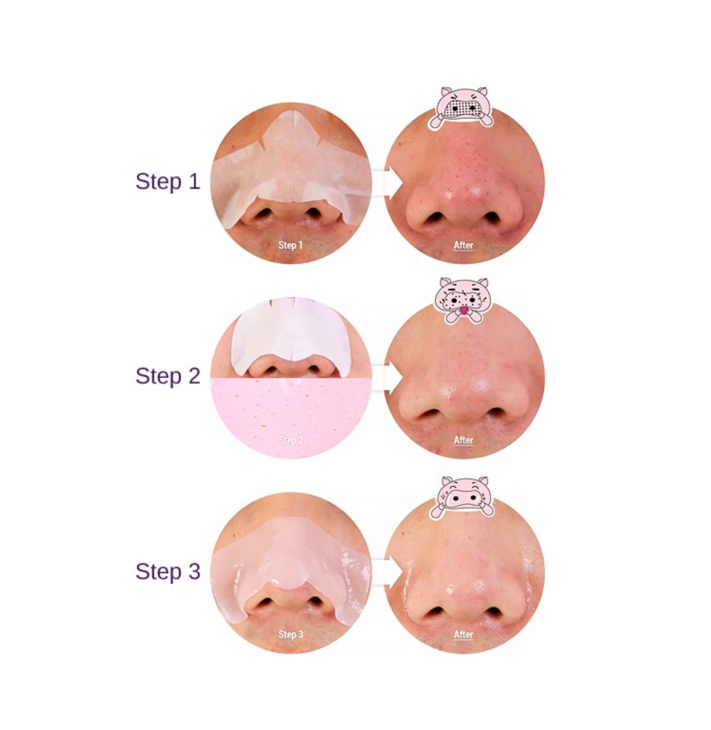 PIG-CLEAR Blackhead 3-Step Kit