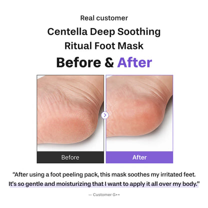 Centella Deep Soothing Ritual Foot Mask