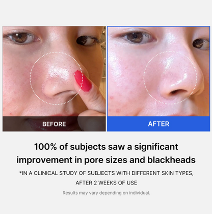 Zero Pore Pad 2.0