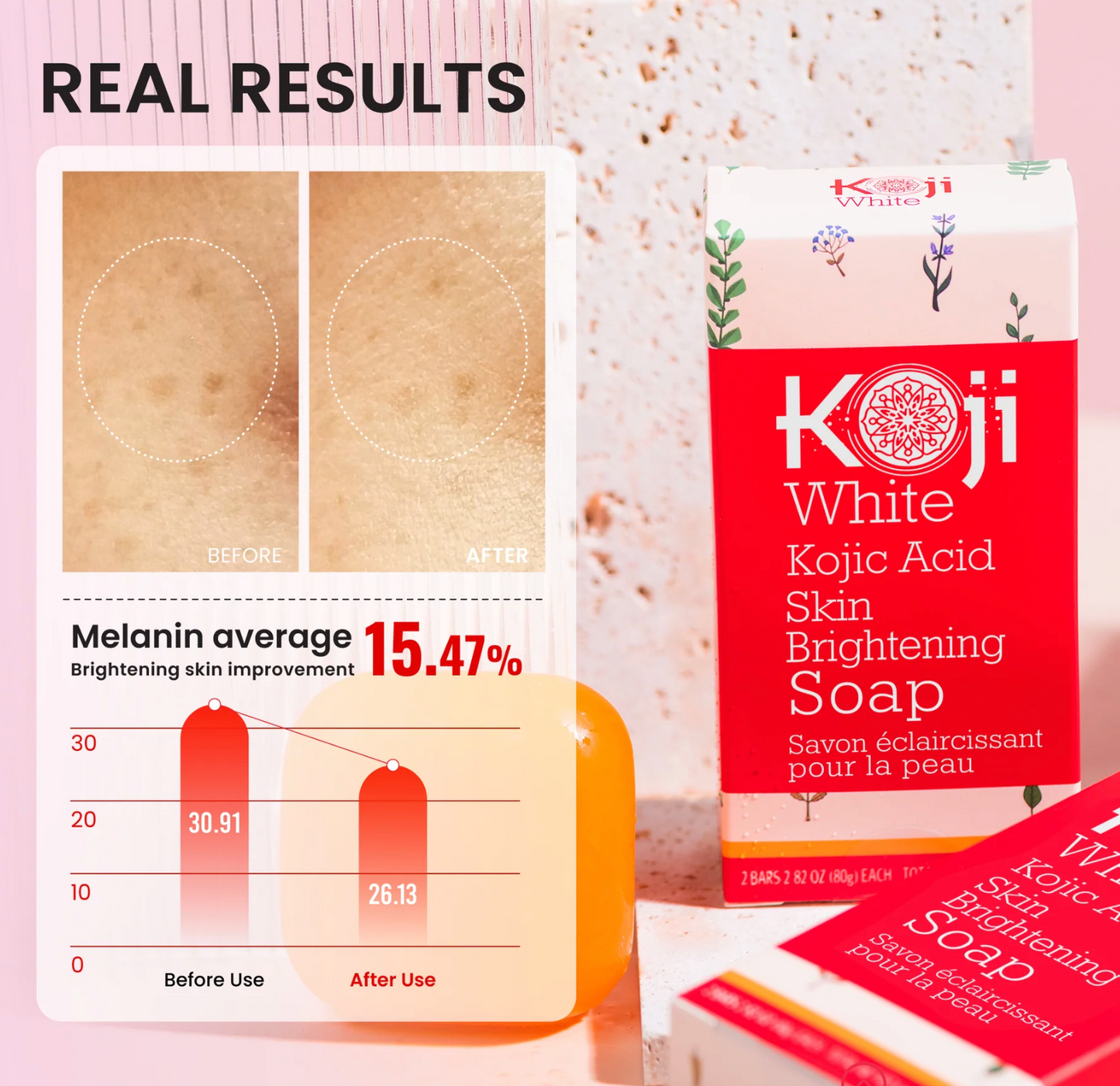 Koji White - Kojic Acid Skin Brightening Soap