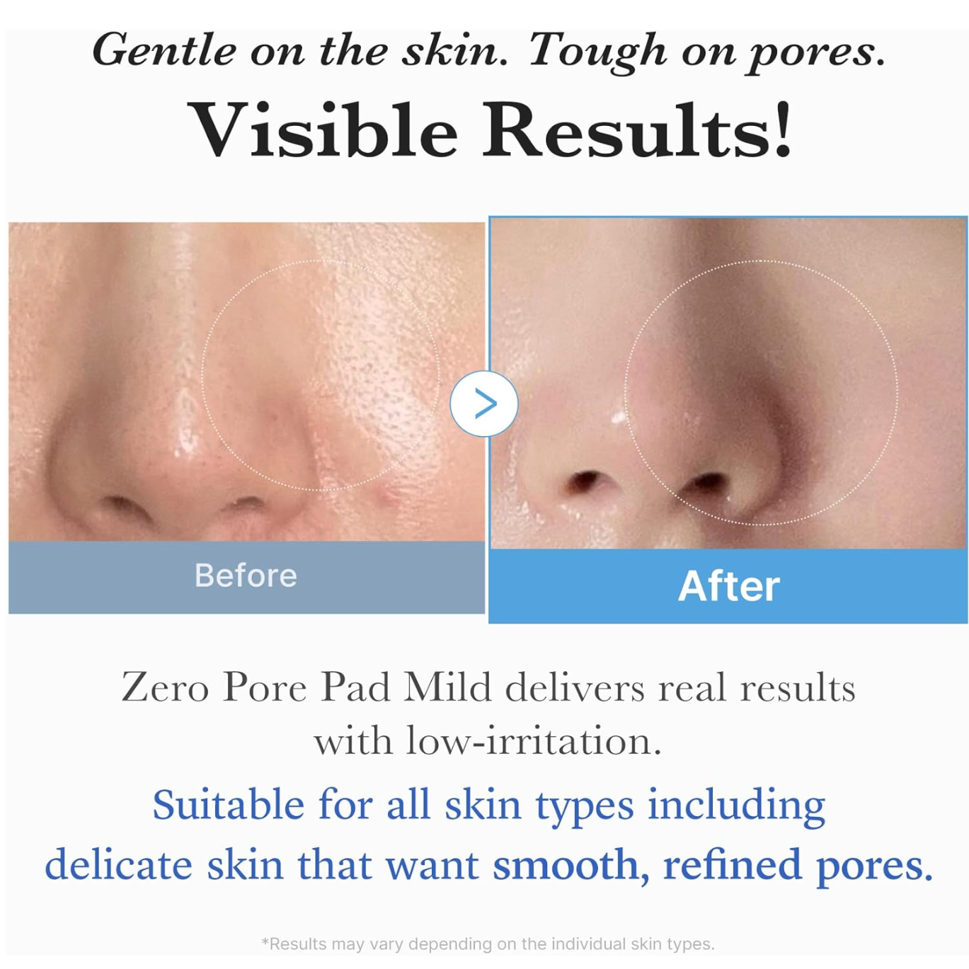 Medicube Zero Pore Pad Mild (70Pcs)