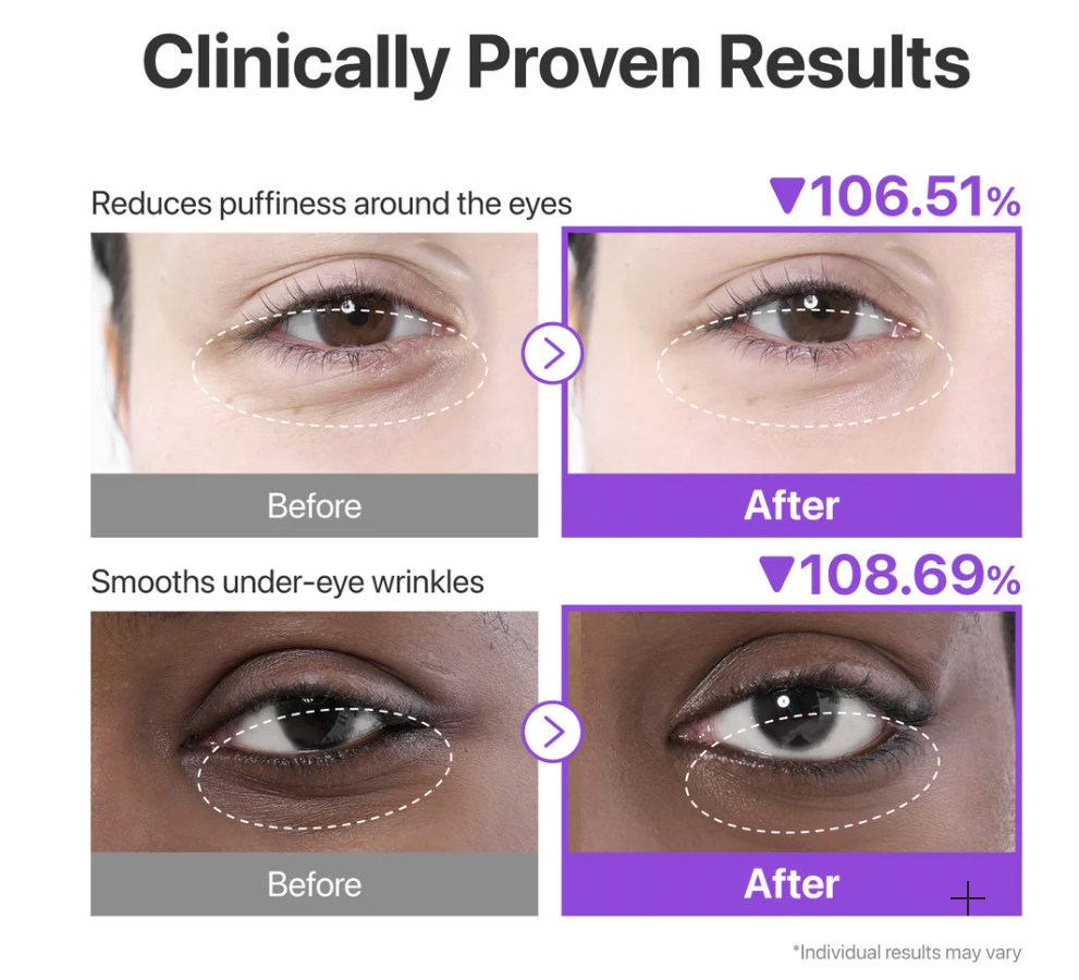 Numbuzin – No.9+ NAD BIO Eye Patch