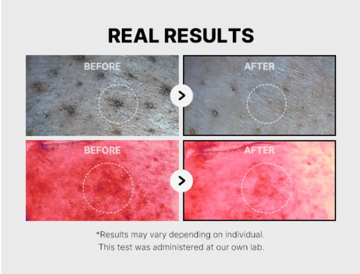 Medicube Red Succinic Acid Peeling Pad