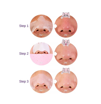 PIG-CLEAR Blackhead 3-Step Kit